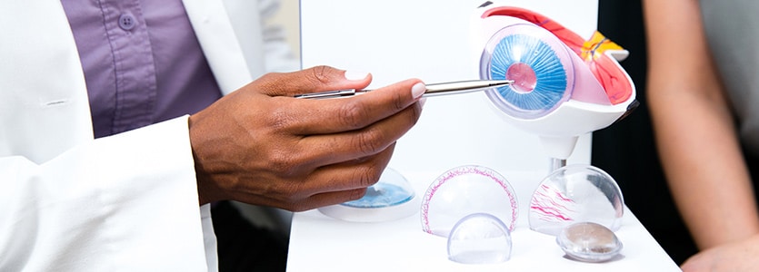 keratoconus