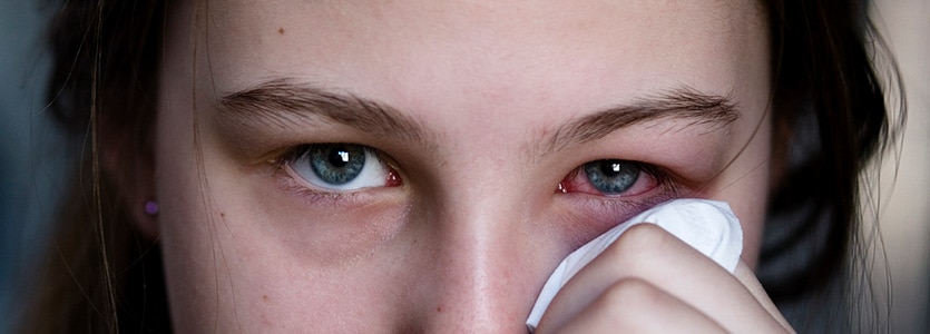 pink eye
