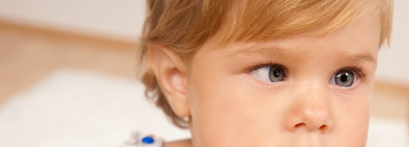 strabismus