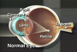 Corneal Disease 1