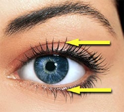 blepharoplasty incision